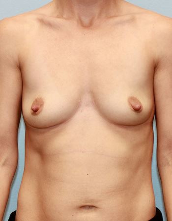 Case 2: Before