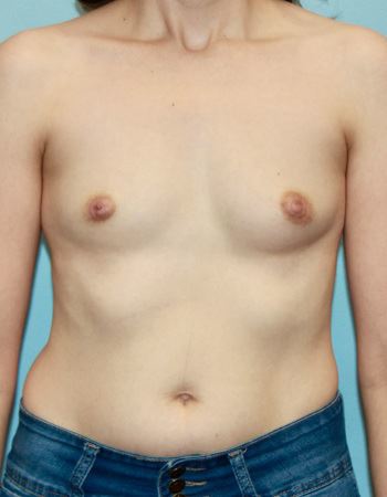 Case 6: Before