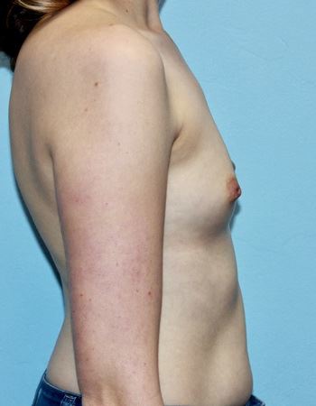 Case 6: Before