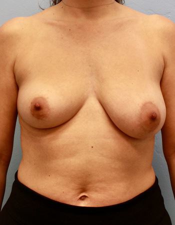 Case 7: Before