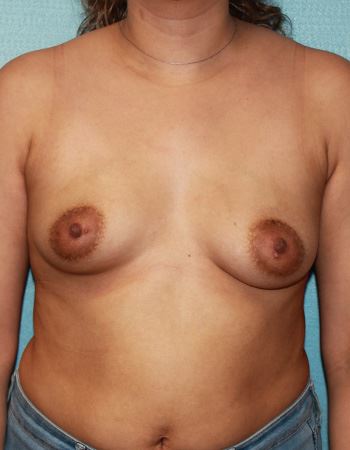 Case 12: Before