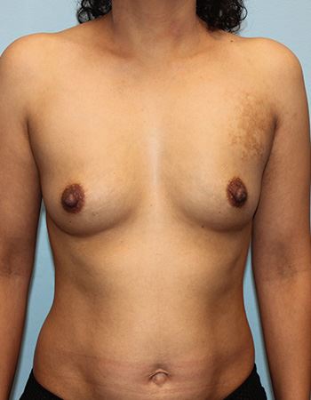 Case 10: Before