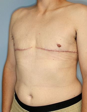 Case: 2 After