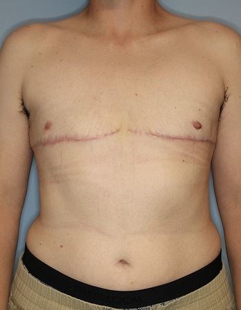 Case: 2 After