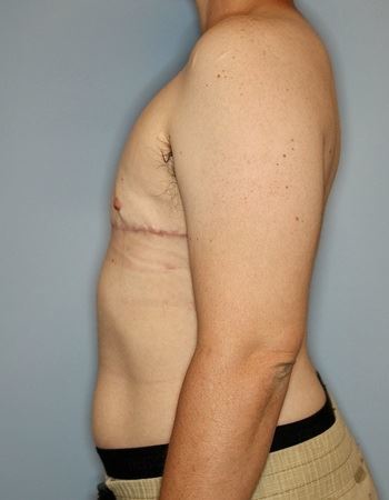 Case: 2 After