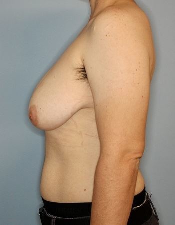 Case: 2 Before