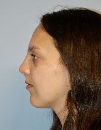 Case 10: After