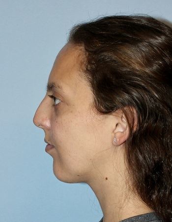 Case 10: Before