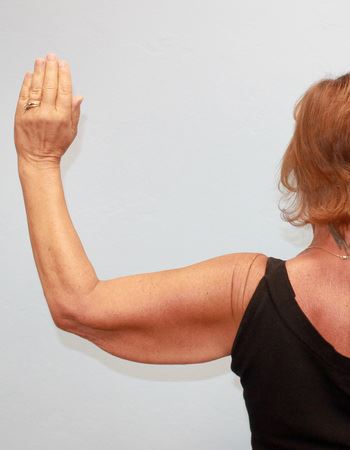 Case 1: Before Photo