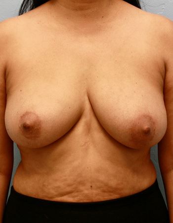 Case 1: Before Photo