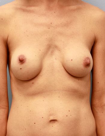 Case 1: Before Photo