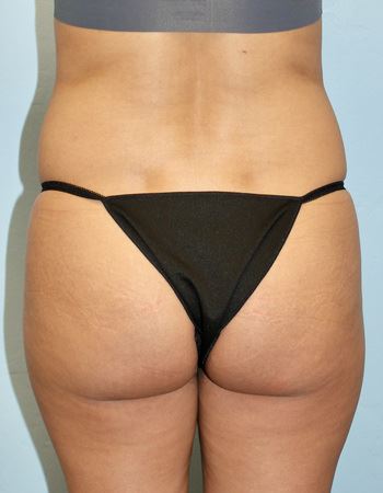 Case 1: Before Photo