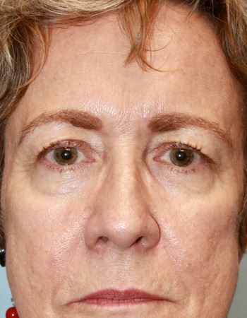 Case 1: Before Photo