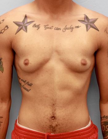 Case 1: Before Photo