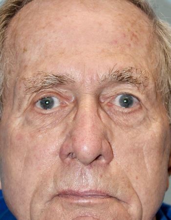 Case 1: Before Photo