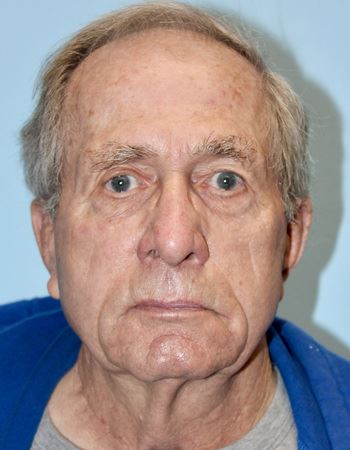 Case 1: Before Photo