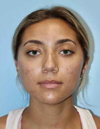 Case 1: Before Photo