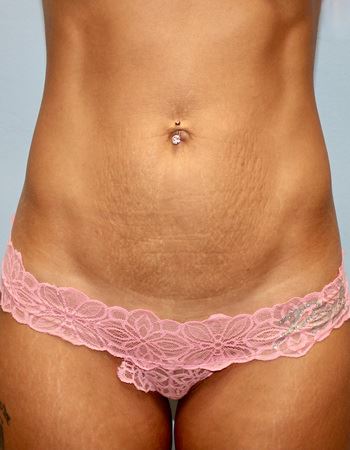 Case 1: Before Photo